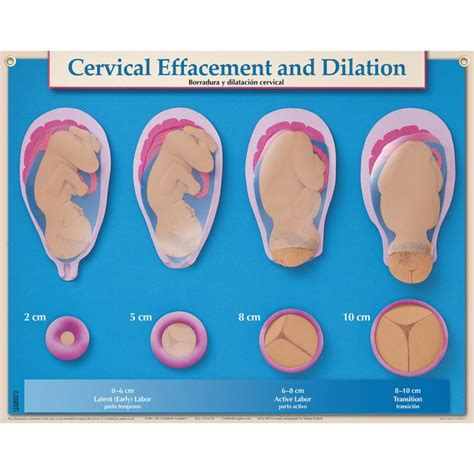Cervical Effacement And Dilatation Chart Capers Bookstore