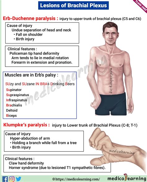Table From Traumatic Lesions Of The Brachial Plexus An Analysis Of My