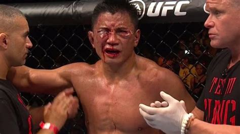 Cung Le Suffers Gruesome Eye Injury Against Michael Bisping During Ufc Fight Night 48