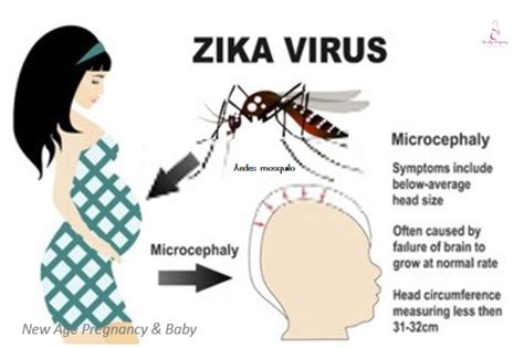 everything a pregnant woman needs to know about the zika virus pregnancy in singapore