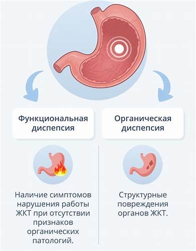 Язва желудка лечение препараты диета Диспепсия - причины, симптомы, препараты для лечения Диспепсия - причины, симптомы, препараты для лечения Язва желудка лечение препараты диета
