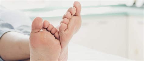 Experts In Hammertoe Surgery Southern Oregon Foot And Ankle