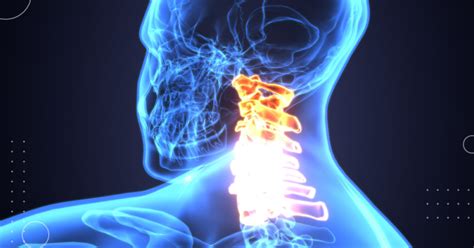 Understanding Spinal Cord Injuries Physicians Premier Er