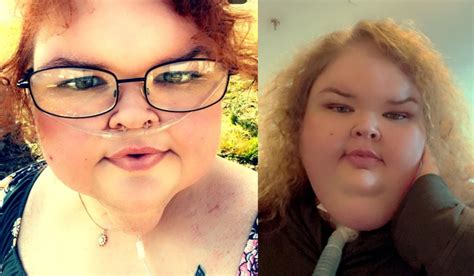 1000 Lb Sisters Tammy Slaton Ready To Undergo Skin Removal Surgery After Weight Loss