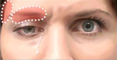 The cost of a botox treatment for frown lines or crows. Botox Side Effects - Are You At Risk?