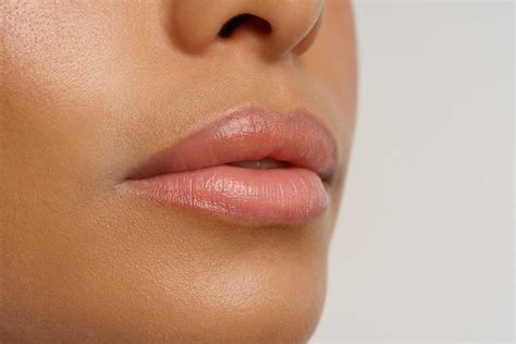 Sites For Botox Lip Flip Hot Sex Picture