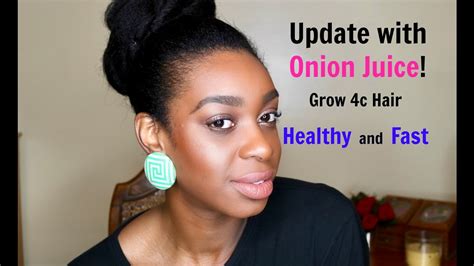 (5 simple tips to grow your hairline/edges back fast). Faster Hair Growth with Onion juice on 4c natural hair ...