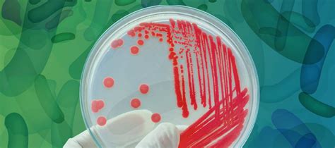 Your Guide To A Bacterial Colony Hudson Robotics