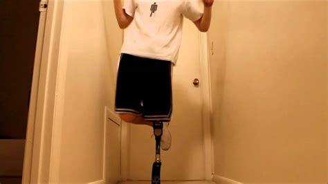 Above Knee Amputee Hopping On Prosthesis Youtube