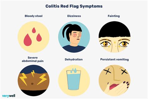 Colitis Signs Symptoms And Complications