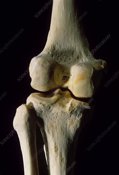 Rear view of the bones of a human left knee joint - Stock Image - P116