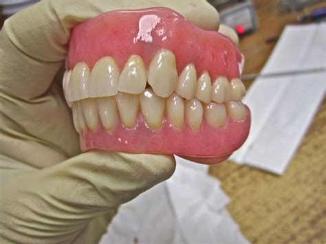 Immediate Dentures | Temporary Dentures Portland, Beaverton, Gresham Oregon