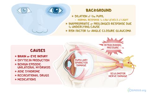Mydriasis What Is It Pronunciation Causes Glaucoma Risk Factor And