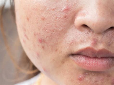 10 Rashes That Could Reveal A Dermatologic Disease