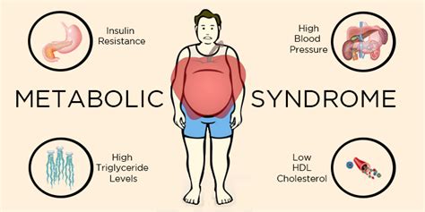 Metabolic Syndrome Causes Symptoms Diagnosis Treatment How To Relief