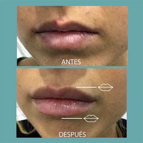 Simple Science: How to Make a Volcano with Kids