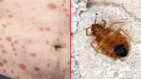 10 Signs Of Bed Bugs To Never Ignore Signs Of Bed Bugs Bed Bugs