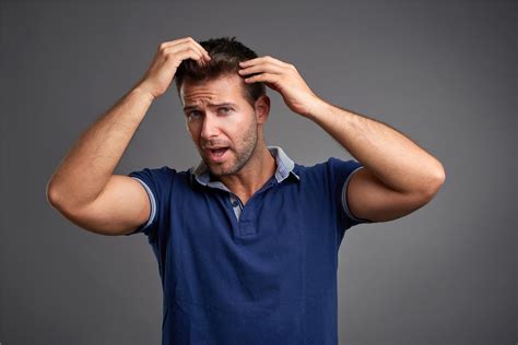Men Hair Loss Information Chr Clinic