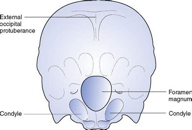 Bones of the head and trunk | Nurse Key