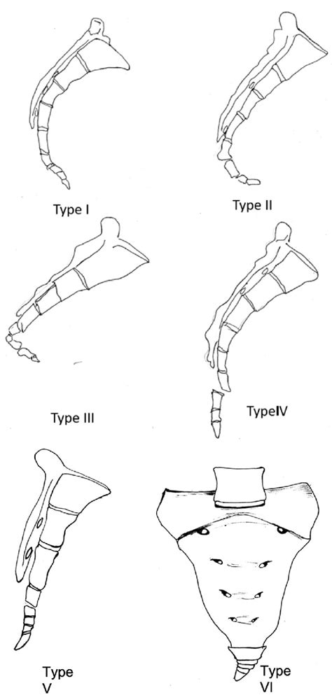 Schematic Representation Of Six Morphological Variants Of Coccyx As