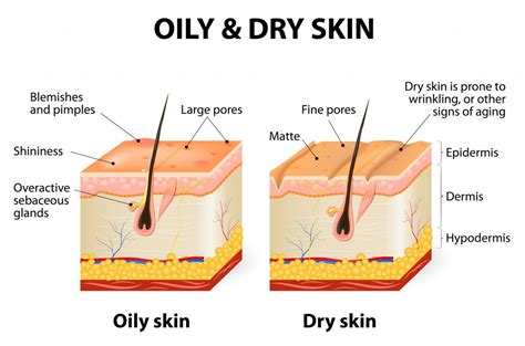 Dry Skin Dilema Aj Retreat