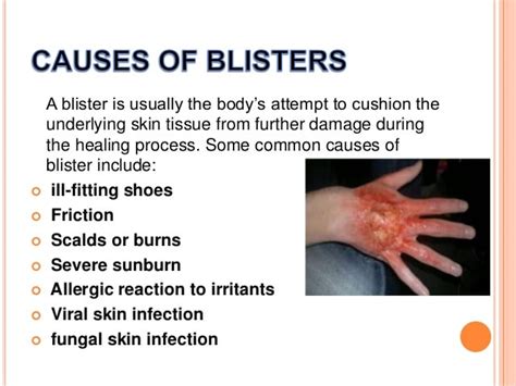 Blister First Aid