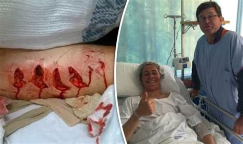 Great White Shark Attack In Australia Cooper Allen Injured World