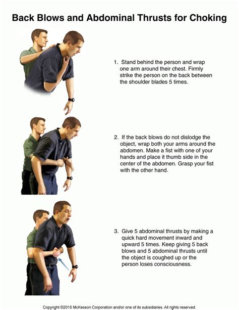Back Blows And Abdominal Thrusts For Choking Illustration Tufts