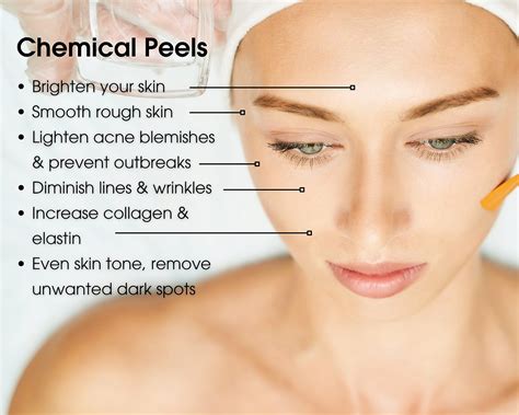 How Chemical Peels Can Improve Your Skin
