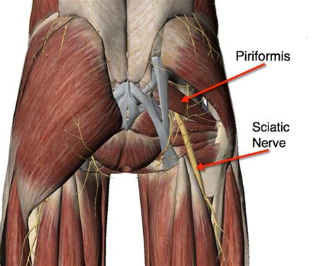 Piriformis Syndrome A Real Pain In The Butt Pikes Peak Sports