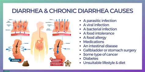 What Causes Diarrhea After Gallbladder Surgery