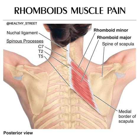 Rhomboid Pain