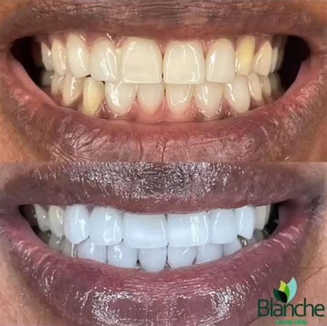 Best Dentists In Lagos And Abuja Best Dental Clinic