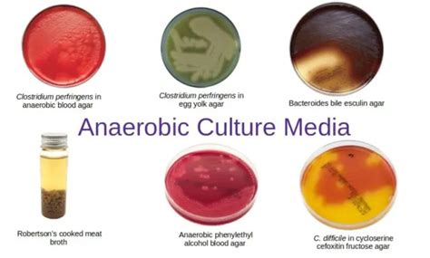 Anaerobic Culture Media Microbe Online