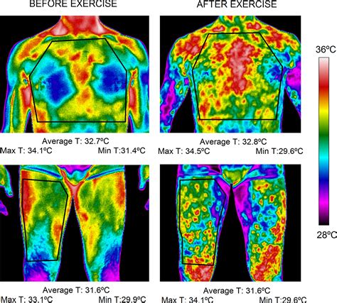 Insights On The Use Of Thermography In Human Physiology Practical