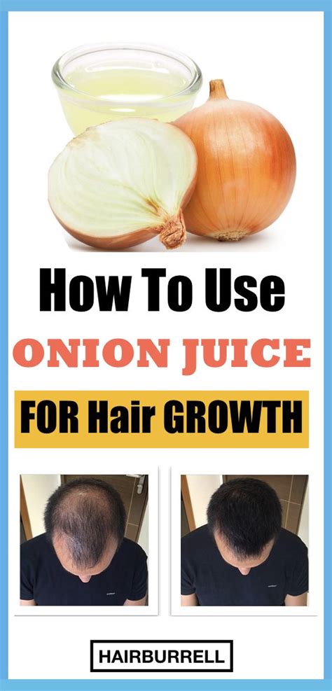 Onions are rich in sulphur, which functions to nurture hair follicles while promoting hair regrowth and preventing hair thinning. How To Use Onion Juice For Hair Growth | Onion juice for ...