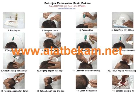 Mesin Bekam Bekam Kepala Tanpa Cukur 2016