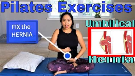 Can I Do Yoga With An Umbilical Hernia Kayaworkout Co