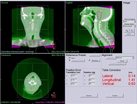 Example Of A Typical System For Image Guided Radiation Therapy Igrt