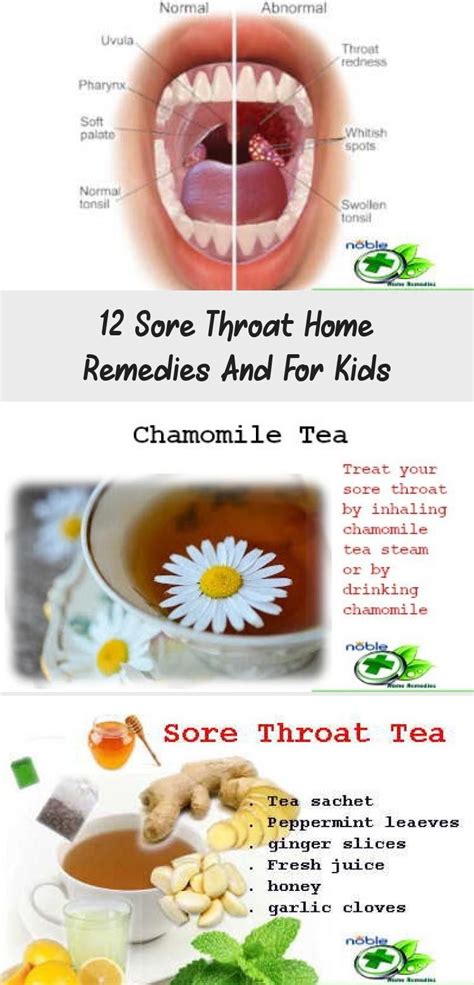 12 Sore Throat Home Remedies And For Kids In 2020 Sore Throat