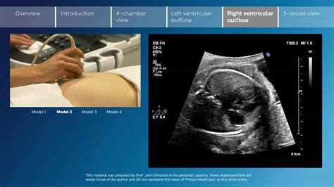 Key Screening Views Of The Fetal Heart Part 5 Right Ventricular