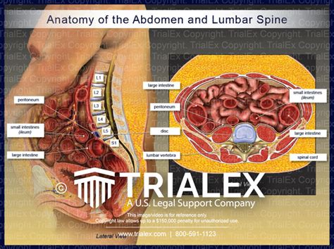 anatomy of the abdomen and lumbar spine trialexhibits inc