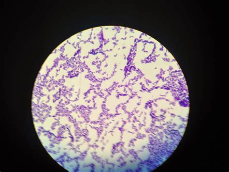 Microbiology Mania: Gram Staining, Including Simple Staining Method 