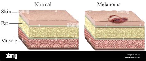 Normal Skin Cells Under Microscope Micropedia