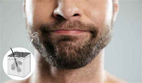 Touching or scratching your face can transfer bacteria to your vulnerable skin, leading to breakouts and infection. Growing a Beard for the First Time? Read This