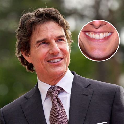 Tom Cruise Has One Of Hollywoods Most Famous Smiles The Story Behind