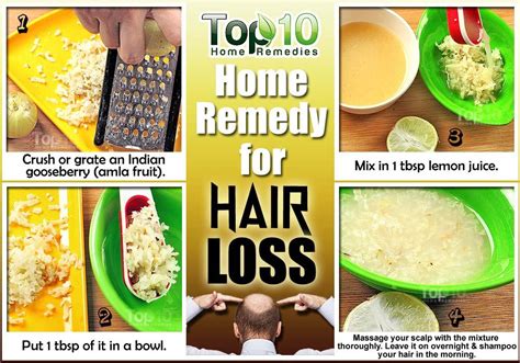 Home Remedies For Hair Loss Top 10 Home Remedies
