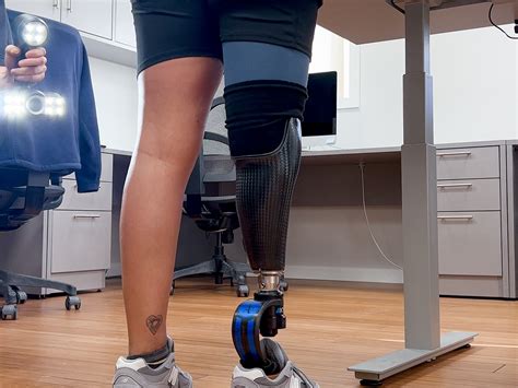 Custom 3d Printing A Step Ahead Prosthetics