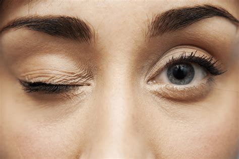 Cómo QUITAR un TIC NERVIOSO del ojo Hay que ir al MÉDICO