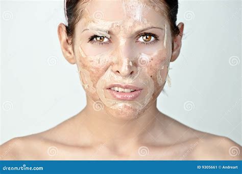 Woman With Skin Peeling Stock Image Image Of Hurting 9305661